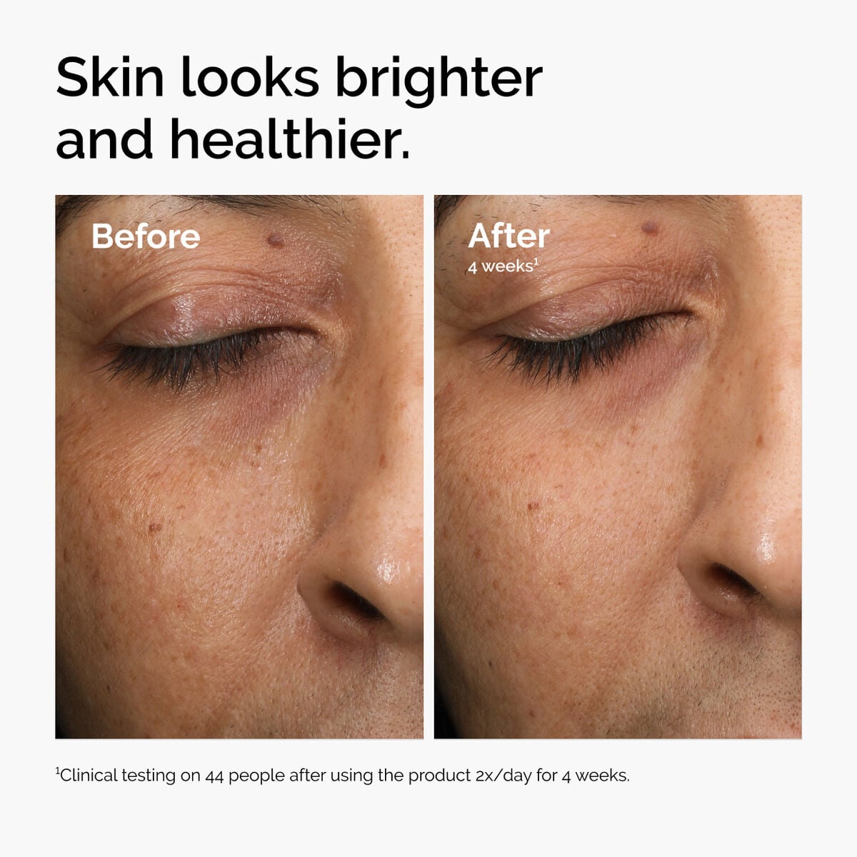 multi-antioxidant-radiance-serum-x5 ord-mars-before-after-healthy.jpg